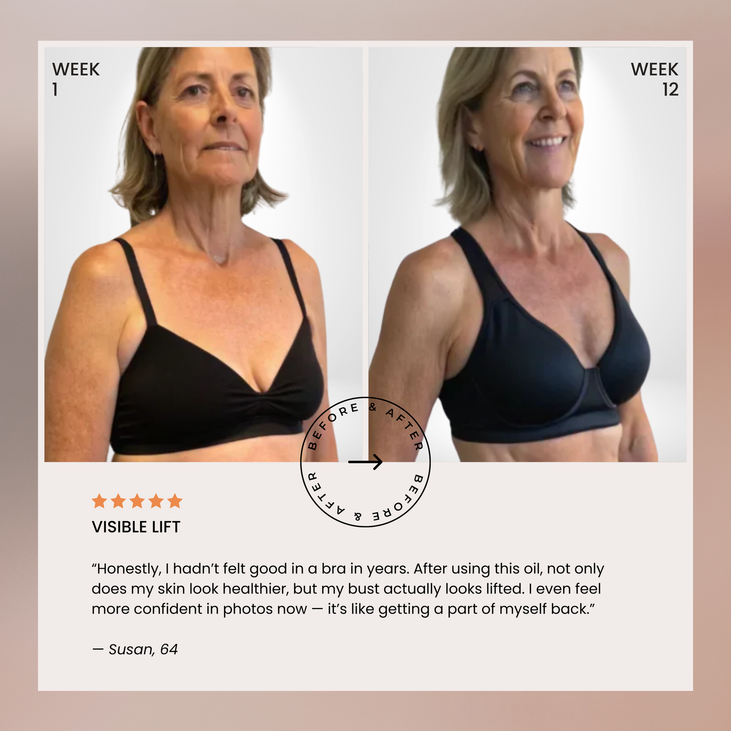 Lumera’s Bust Lift Oil