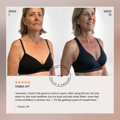 Lumera’s Bust Lift Oil