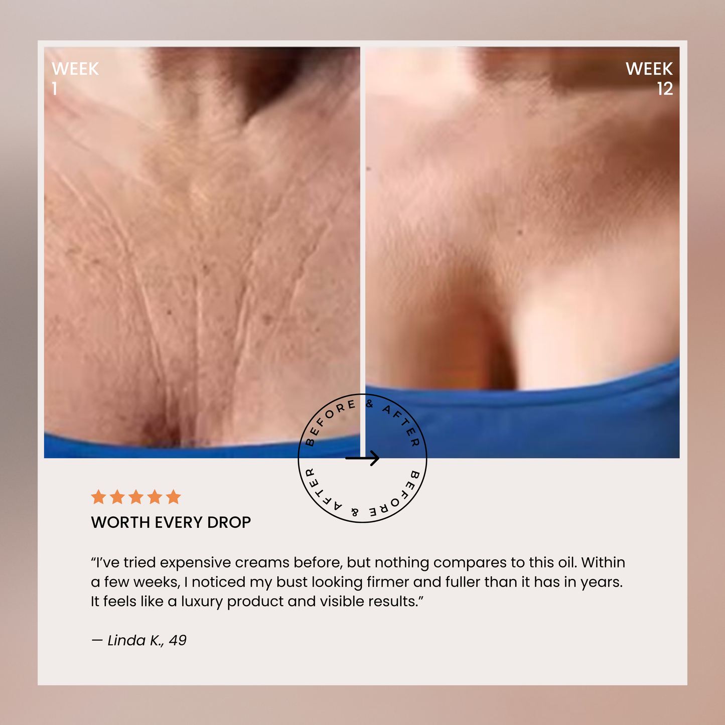 Lumera’s Bust Lift Oil